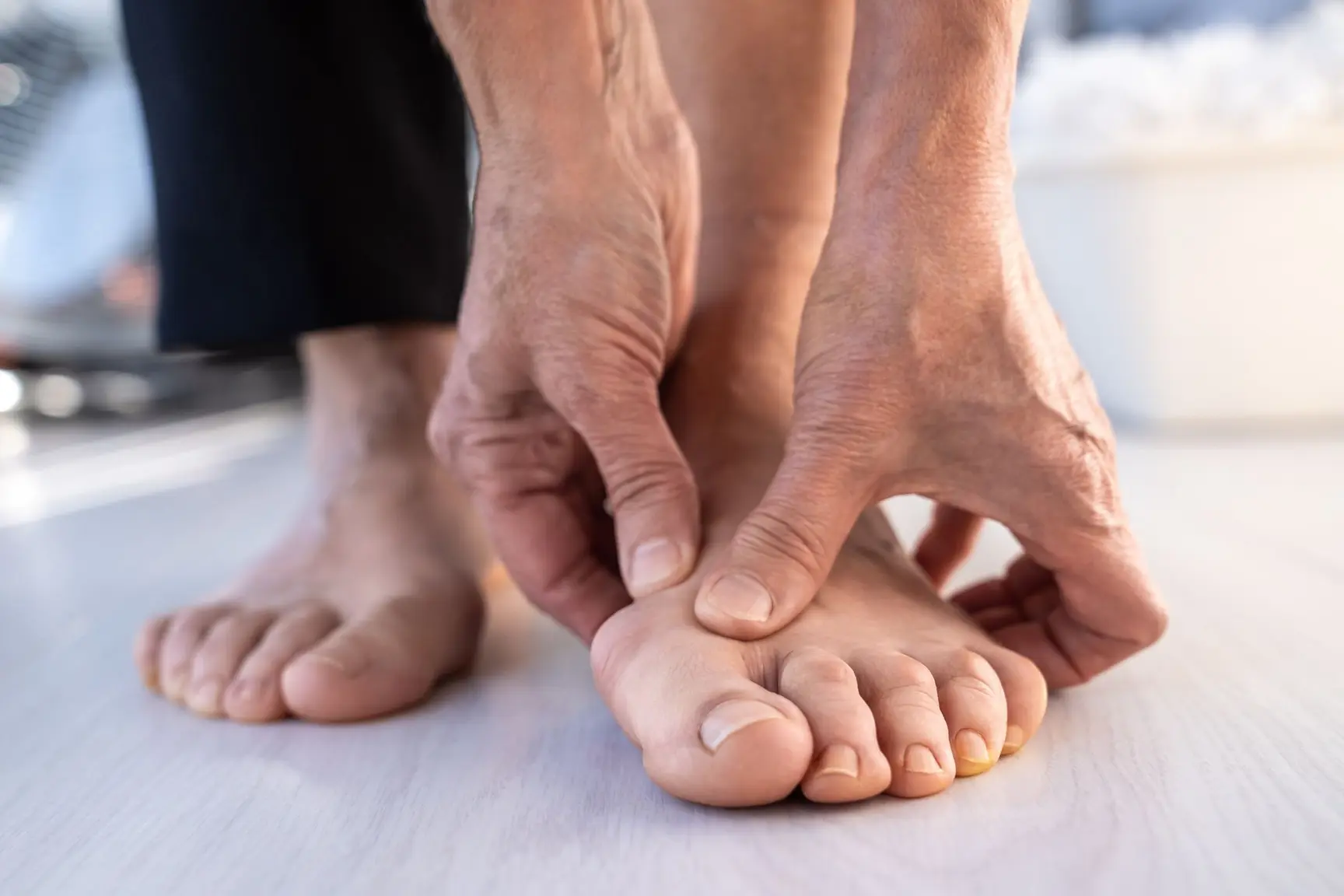 Kvinne tar på fot som er deformert av hallux valgus