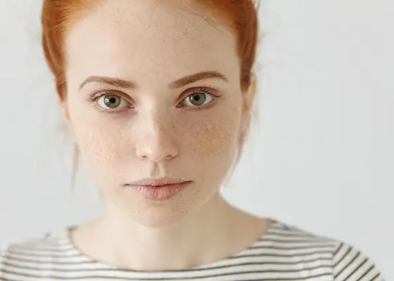 Lupus Lupus