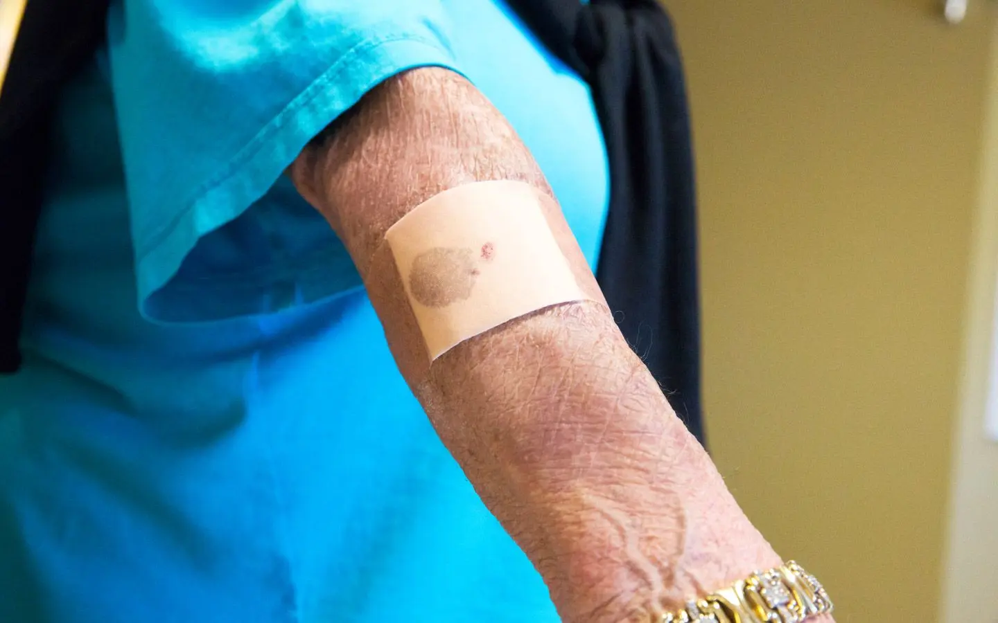 Arm med plaster