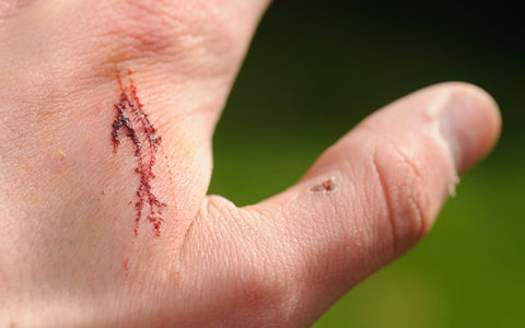 Arrbehandling
