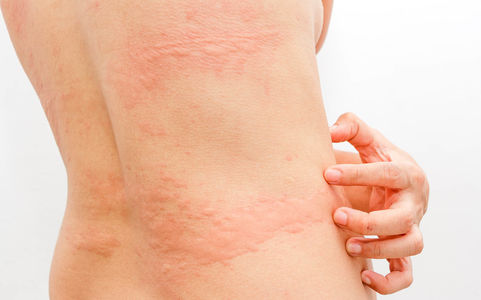 Svetteutslett Svetteutslett