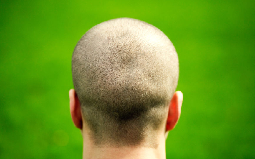 Solbrent hodebunn flass Solbrent hodebunn flass