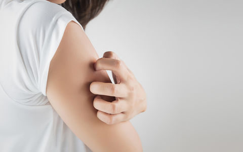 Keratosis pilaris
