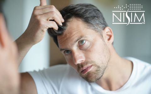 NISIM hjelper mot hårtap og gjenvekst av hår