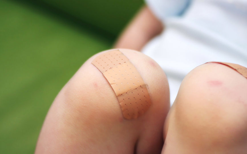 Blemmer etter plaster Blemmer etter plaster