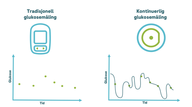 Illustrasjon som viser blodsukkerkurve