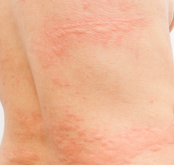 Nærbilde av elveblest på ryggen.