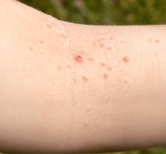 Nærbilde av mollusker på innsiden av albuen.